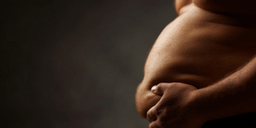 Which Diet Supplement is Best for You?